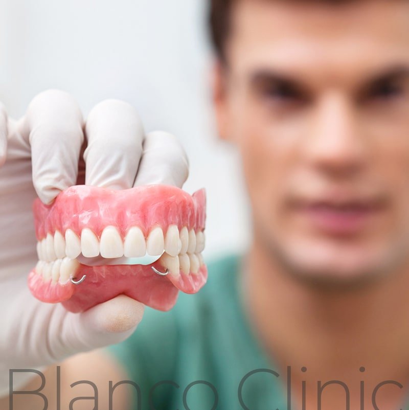 протезирование зубов в стоматологии